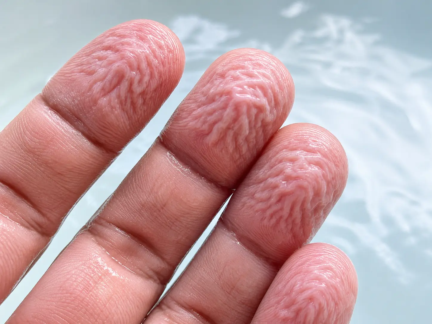 Why Do Fingers Wrinkle in Water?