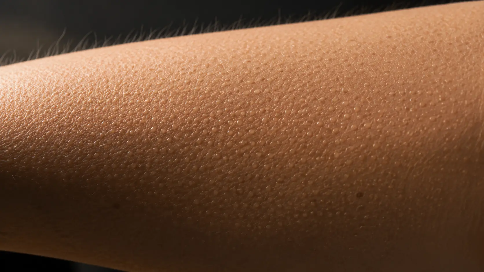 What Causes Goosebumps?