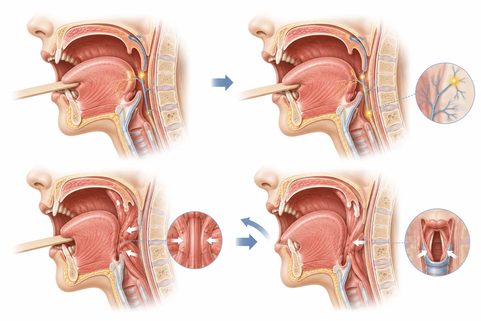 Why Do We Have a Gag Reflex? explanatory diagram