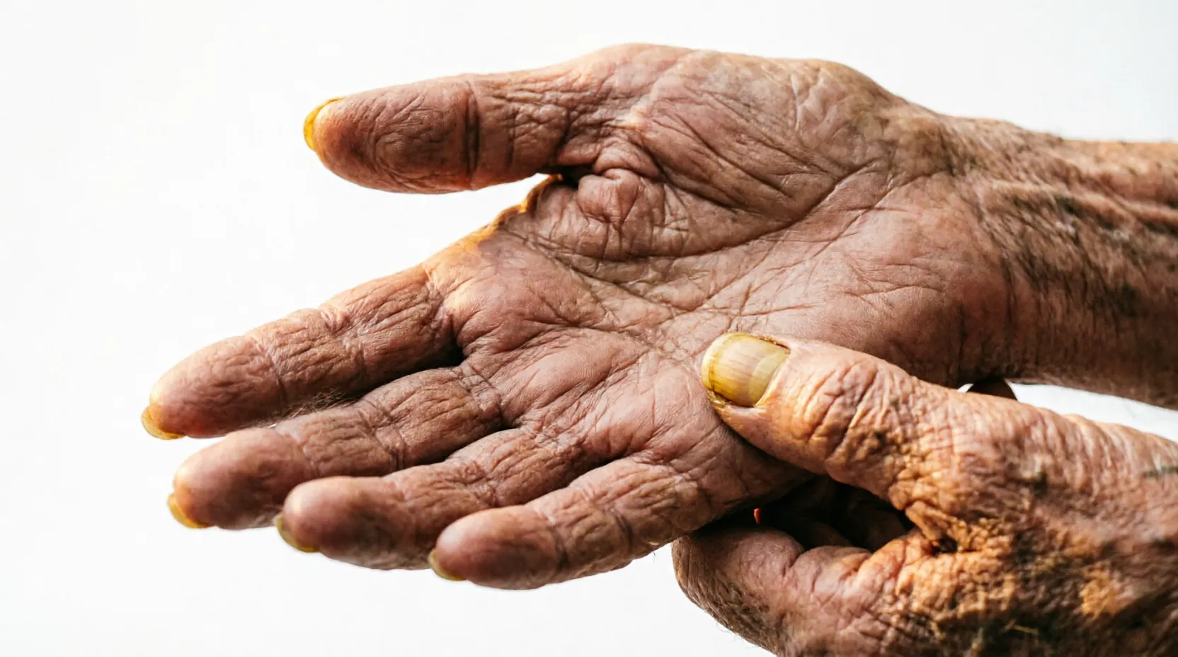 Close-up comparison of a young hand and an aged hand showing palm line differences