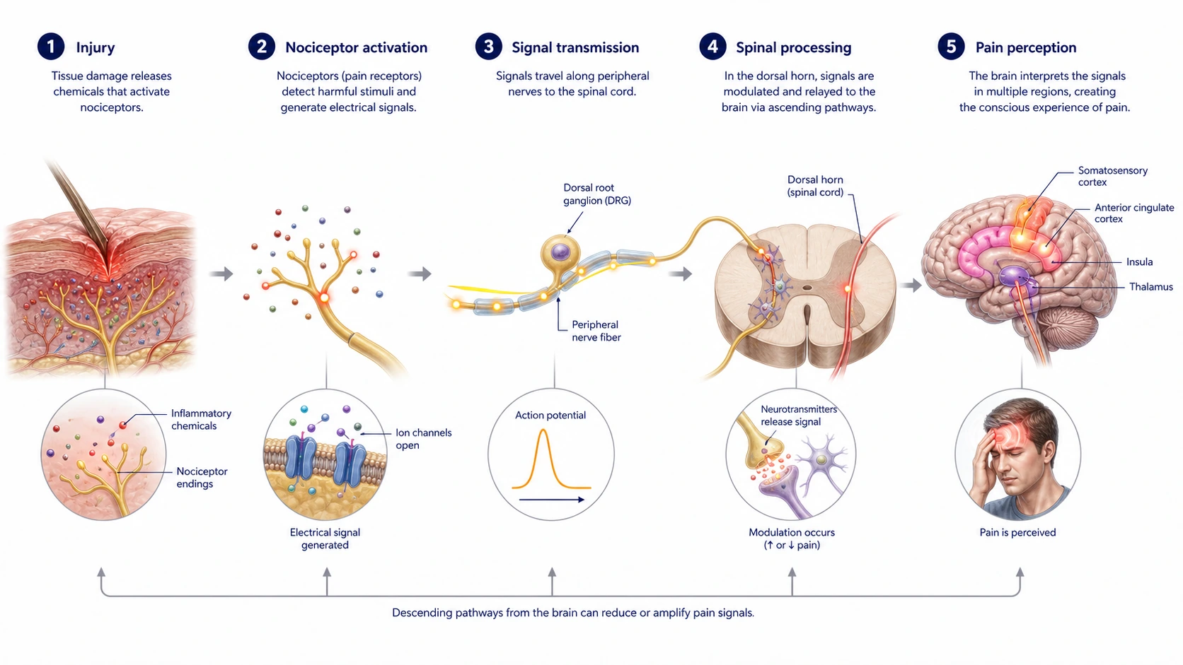How Does Pain Work? explanatory diagram