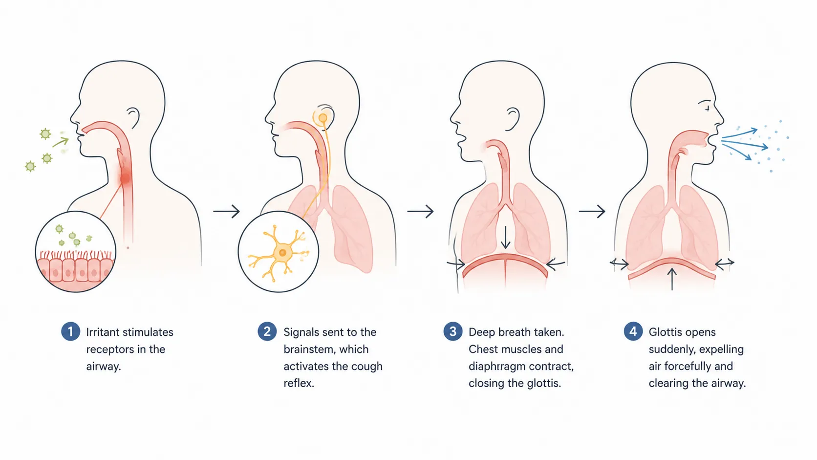 Diagram showing irritant receptor activation, vagus nerve signal, brainstem response, and glottis mechanics during a cough