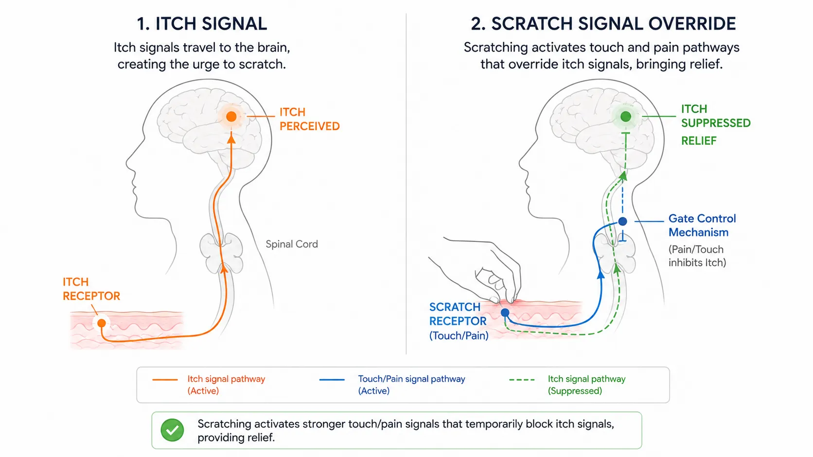 Diagram showing pruriceptor activation, spinal cord relay, brain response, serotonin feedback loop, and itch intensification